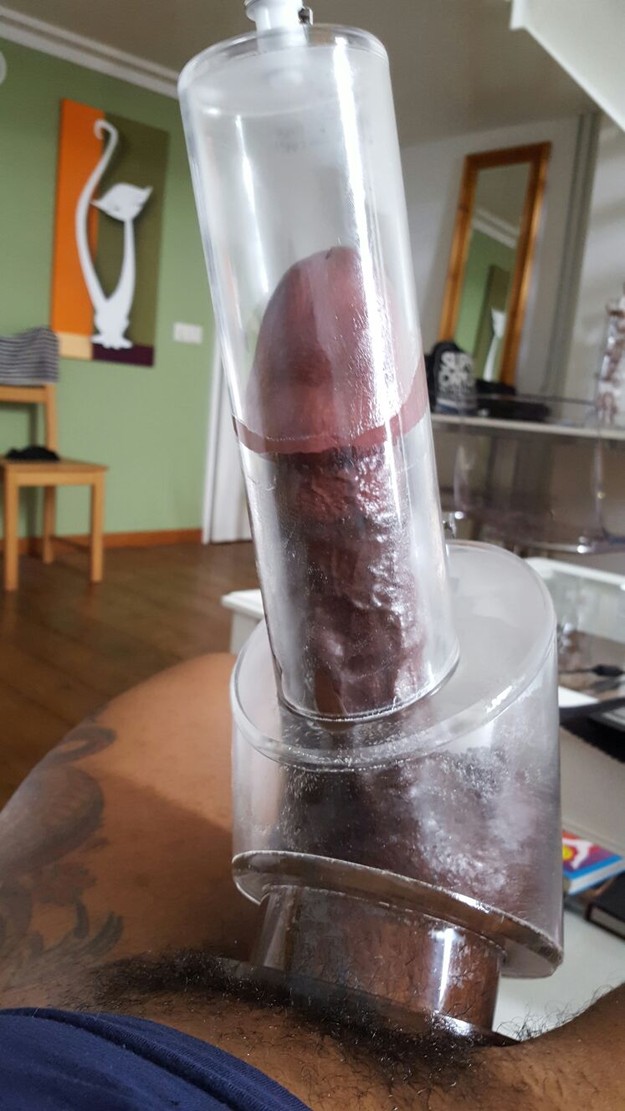 Enlarged Cock 116