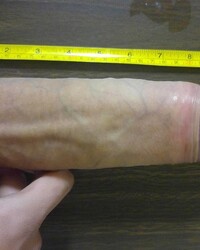 photo-thumb