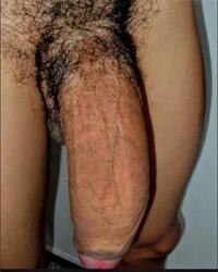 photo-thumb