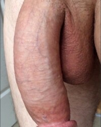 photo-thumb