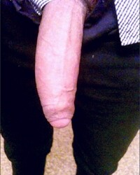 photo-thumb