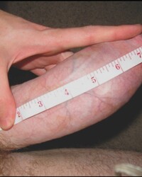 photo-thumb