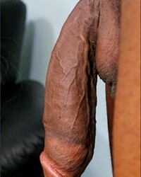 photo-thumb