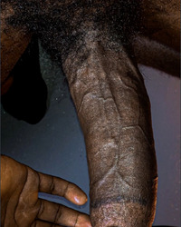 photo-thumb