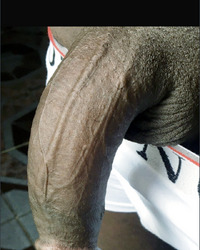 photo-thumb