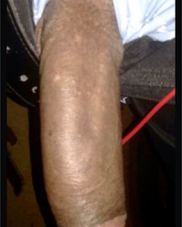 photo-thumb