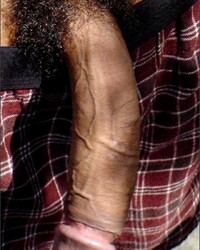 photo-thumb