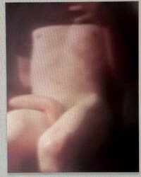 photo-thumb