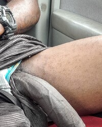 photo-thumb