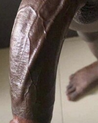 photo-thumb