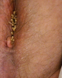 album-cover