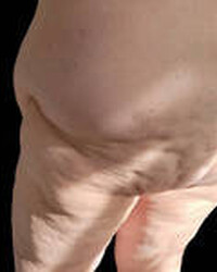 photo-thumb