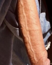 photo-thumb