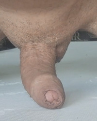 photo-thumb