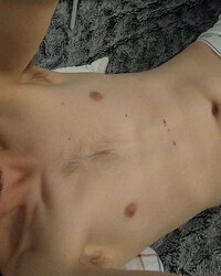 photo-thumb