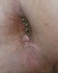 photo-thumb