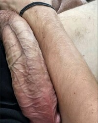 photo-thumb