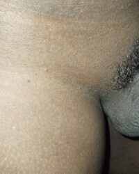 photo-thumb