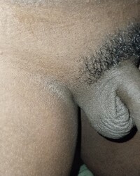photo-thumb
