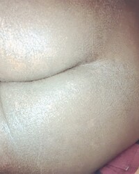 photo-thumb