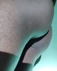 photo-thumb