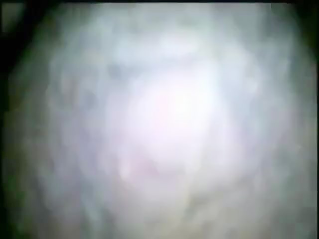 Thumb 8