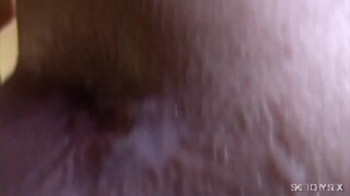 Thumb 8